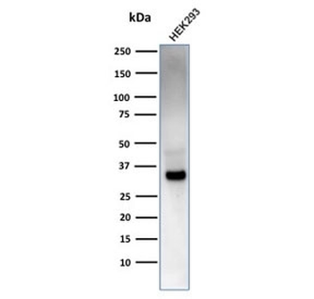 EBAG9 Antibody / Estrogen Receptor Binding Site Associated Antigen 9