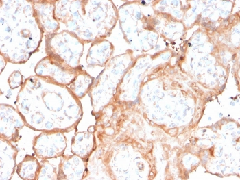 Aurora B Antibody / AURKB
