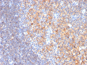 CD19 Antibody / B-lymphocyte marker