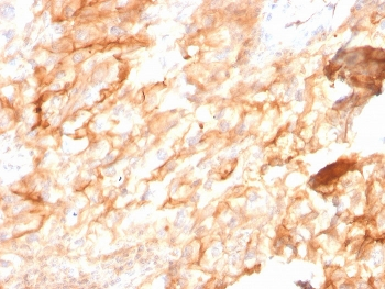 CD10 Antibody / Neprilysin