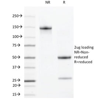 VEGF Receptor 2 Antibody / VEGFR2 / KDR