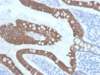Cytokeratin 20 Antibody / CK20