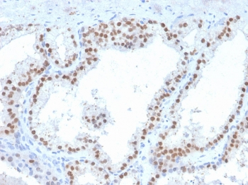 c-RET Antibody