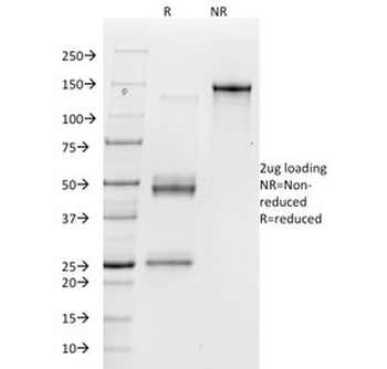 Integrin alpha V Antibody / ITGAV / Vitronectin Receptor