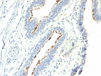 Thomsen-Friedenreich Antigen Antibody / CD176