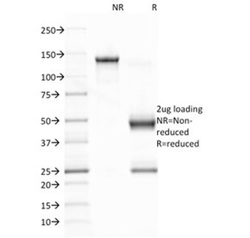 EBV Antibody / Epstein-Barr Virus