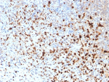 HSV1 Antibody / Herpes Simplex Virus Type I