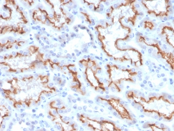 Interferon gamma Antibody / IFNG
