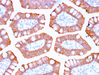 Cytokeratin 20 Antibody / CK20