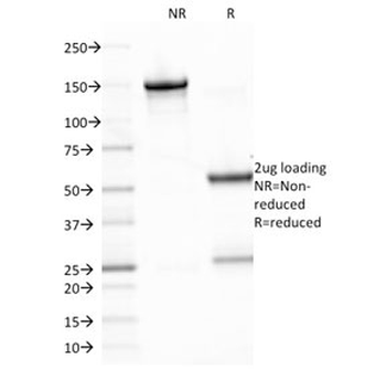 EBV Antibody / Epstein-Barr Virus