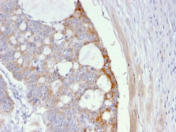 Thomsen-Friedenreich Antigen Antibody / CD176