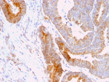 Thomsen-Friedenreich Antigen Antibody / CD176
