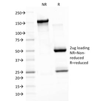 EBV Antibody / Epstein-Barr Virus
