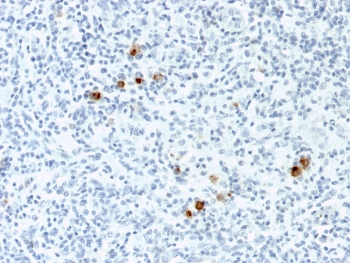 EBV Antibody / Epstein-Barr Virus