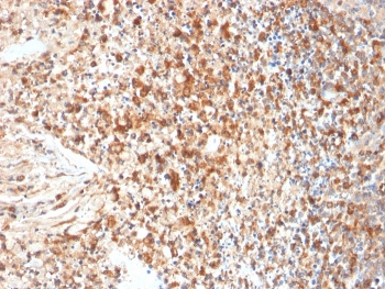 HSV1 Antibody / Herpes Simplex Virus Type I