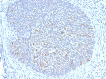 HPV-16 E1/E4 Antibody