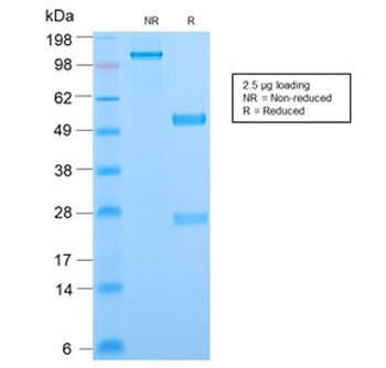 Phosphotyrosine Antibody / P-Tyr
