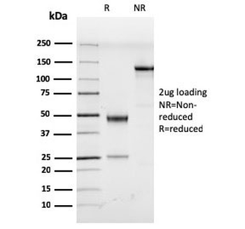 Herpes Virus 8 Antibody
