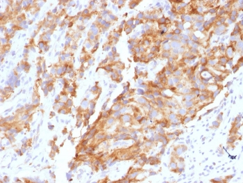 Aurora B Antibody / AURKB
