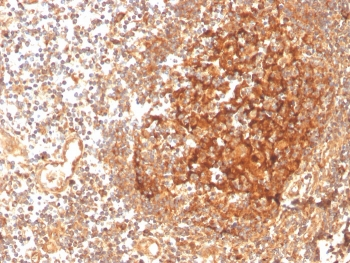 GCLM Antibody / Glutamate-Cysteine Ligase Regulatory Subunit