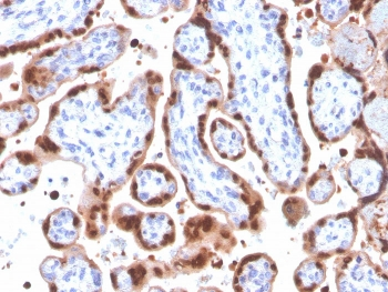 HIF1A Antibody / HIF-1 alpha
