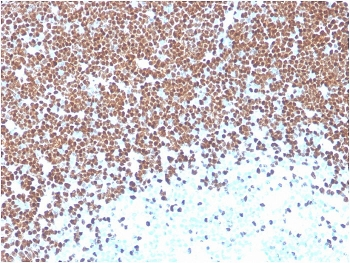 TdT Antibody