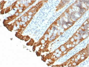 Cytokeratin 8/18 Antibody