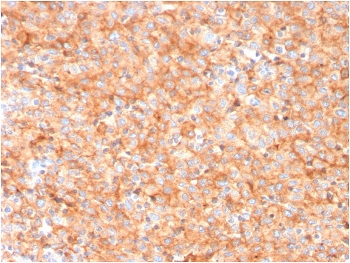 CD63 Antibody / LAMP-3