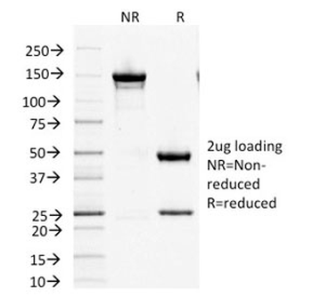 Factor XIIIa Antibody / F13A1