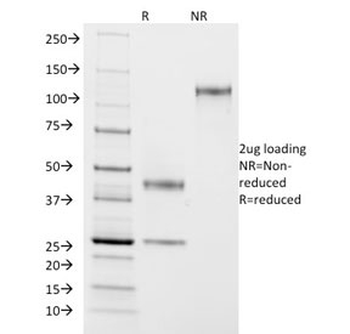 ASRGL1 Antibody / ALP1