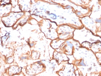 EGF Receptor / EGFR Antibody