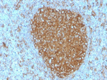 Transferrin Receptor Antibody / TFRC / CD71