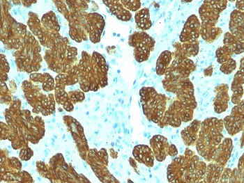 Cytokeratin 5/6 Antibody