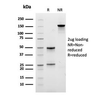 Eosinophil Peroxidase Antibody