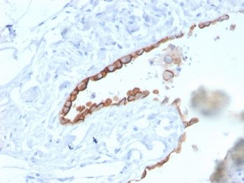 Mesothelin Antibody / MSLN