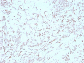 Kindlin-1 Antibody / KIND1