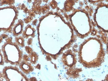 Thyroid Peroxidase Antibody