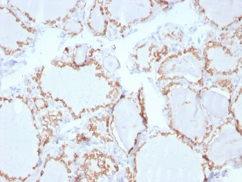 Thyroid Peroxidase Antibody