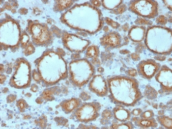 Thyroid Peroxidase Antibody