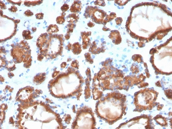 Thyroid Peroxidase Antibody