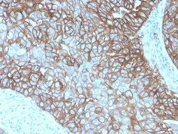 PD-L1 Antibody / B7-H1 / CD274