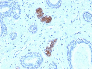 Mammaglobin A Antibody / SCGB2A2