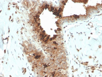 Mammaglobin A Antibody / SCGB2A2