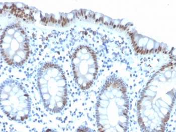 Histone H3 Antibody (pSer10)