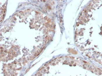 Follistatin Antibody / FST / Activin Binding Protein (FS288 & FS315)