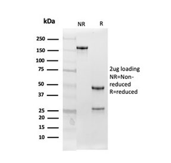 Follistatin Antibody / FST / Activin Binding Protein (FS288)