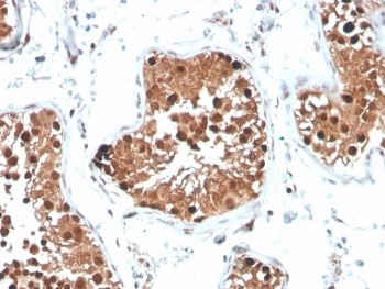 INHA Antibody / Inhibin alpha