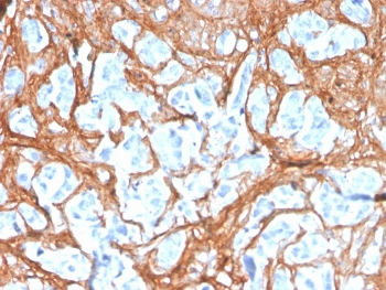 Periostin Antibody