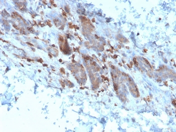 IL1 alpha Antibody / IL1A