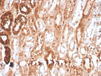 Retinol Binding Protein 4 Antibody / RBP4